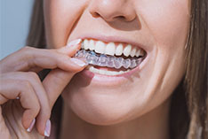 invisalign